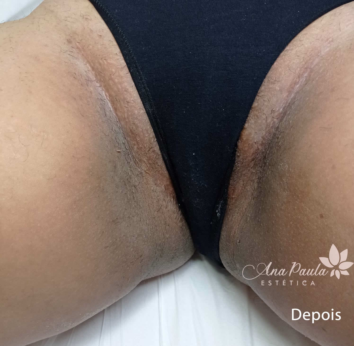 Slider Antes e Depois