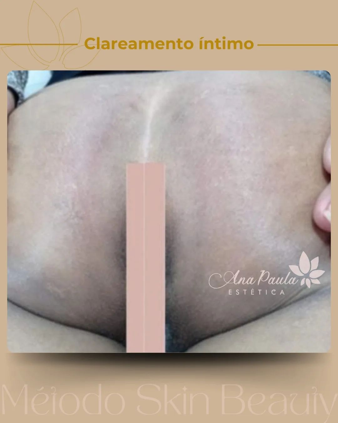 Slider Antes e Depois