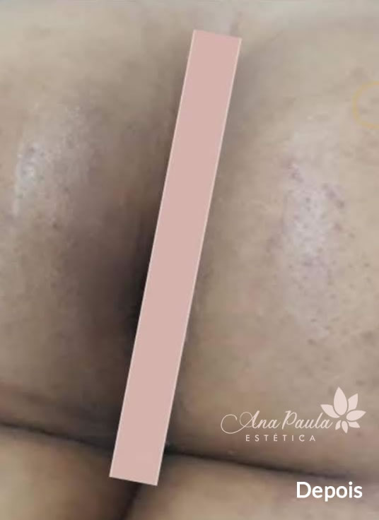 Slider Antes e Depois