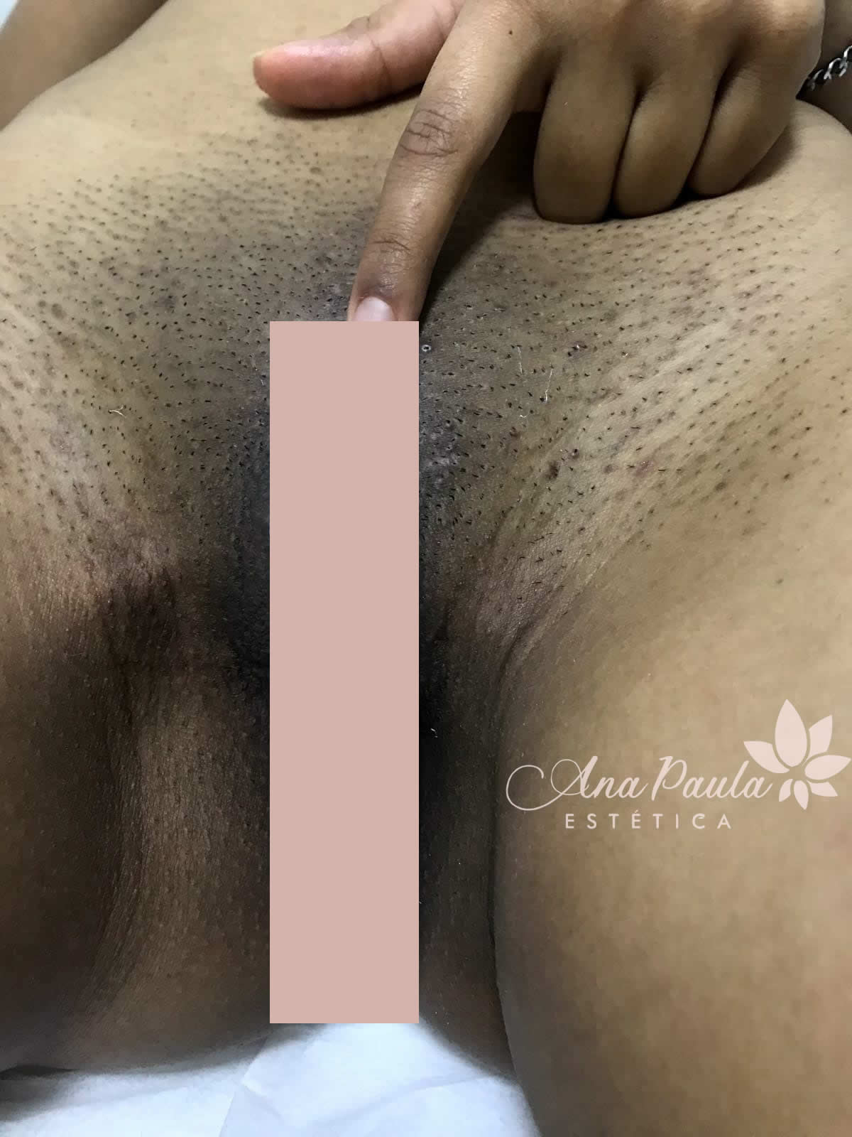 Slider Antes e Depois