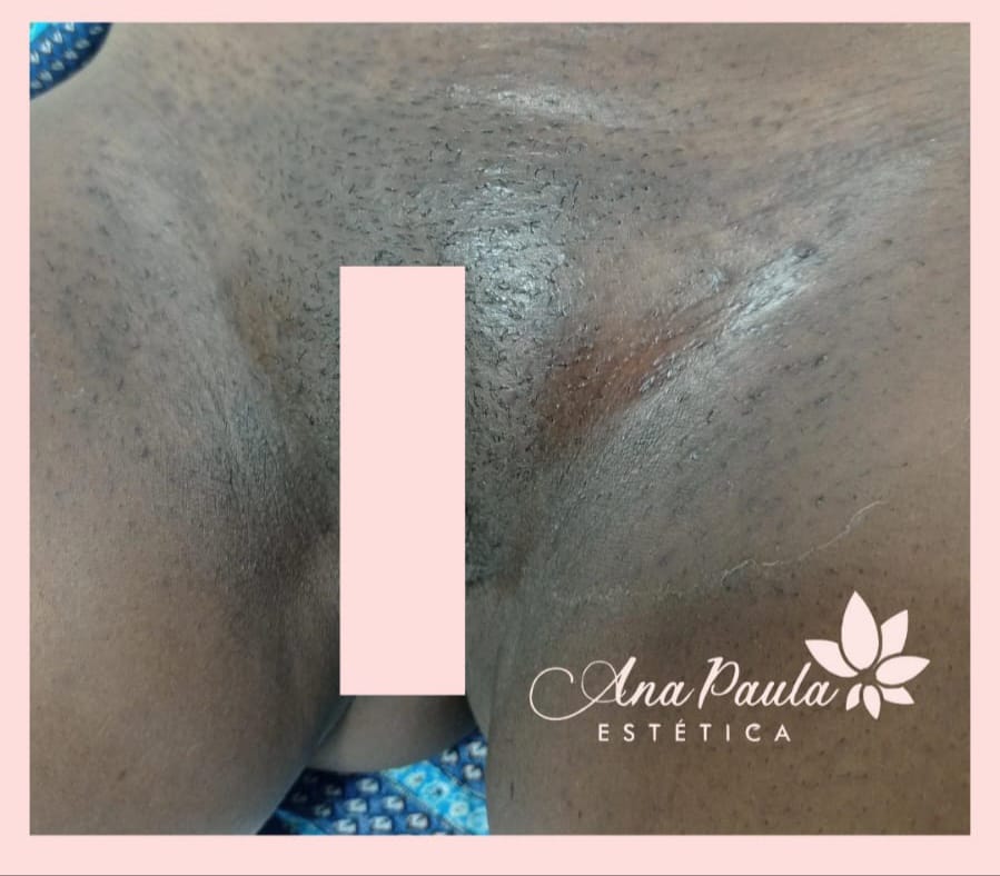 Slider Antes e Depois