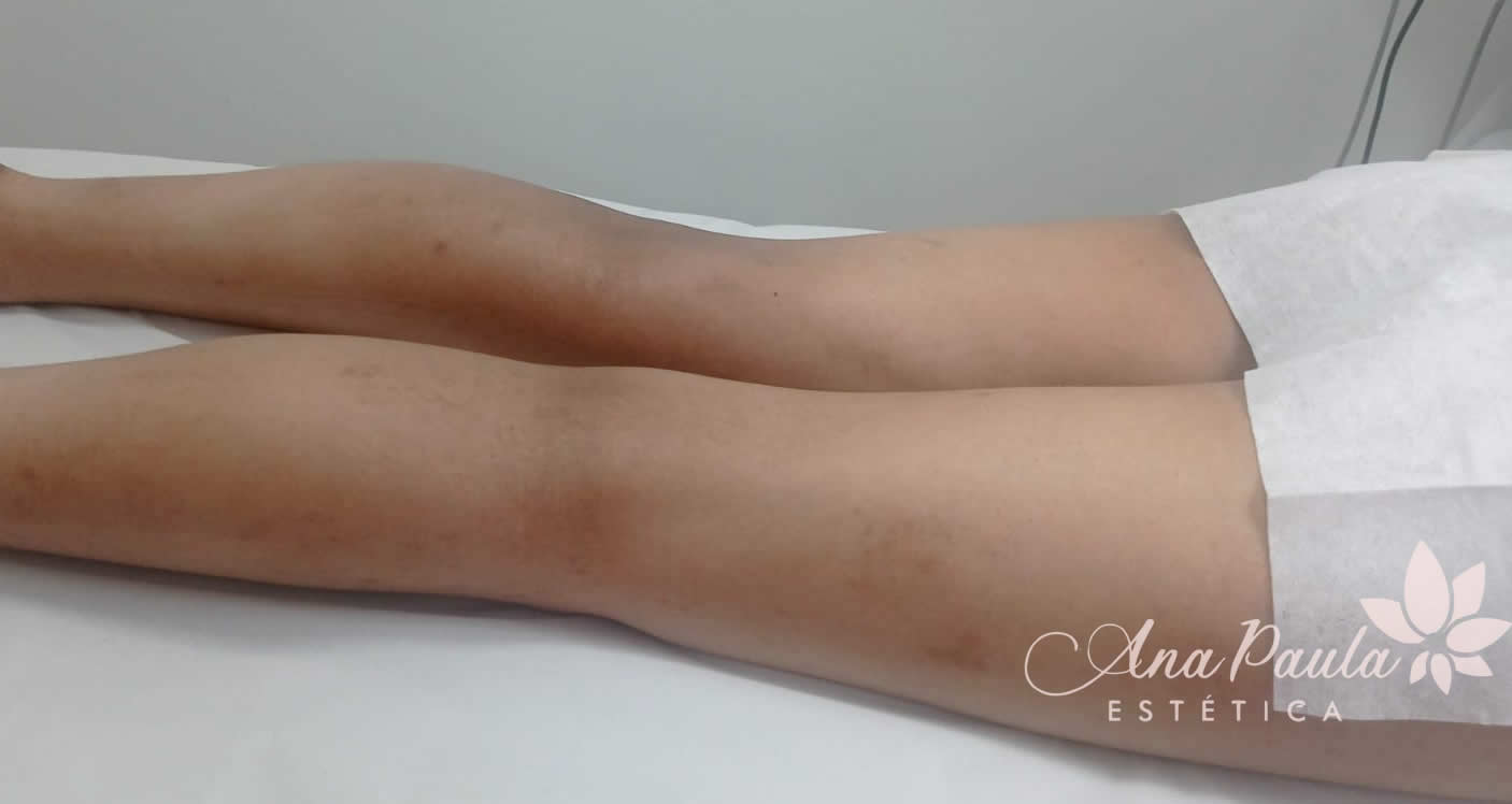 Slider Antes e Depois